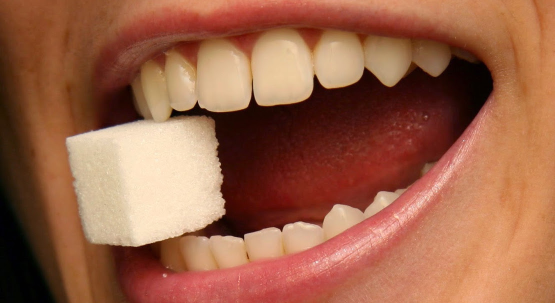 В чем сложности имплантации зубов при диабете